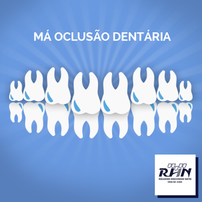 Você sabe o que é a Má Oclusão Dentária?