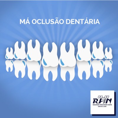 Você sabe o que é a Má Oclusão Dentária?